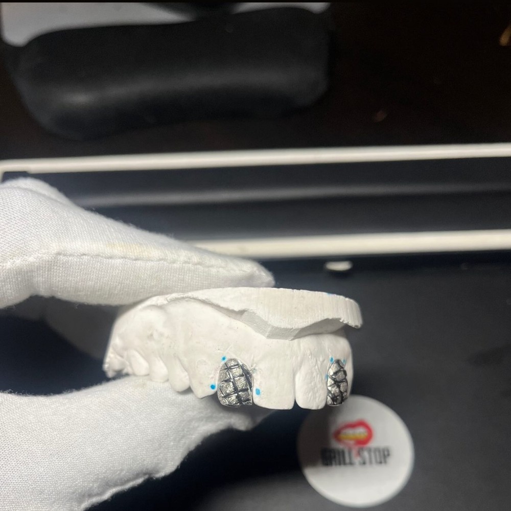 Custom grillz dental mould with diamond-set teeth in progress